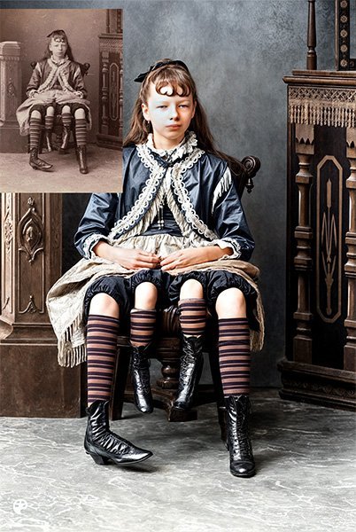 osephine Myrtle Corbin, known as "The Four-Legged Girl"
